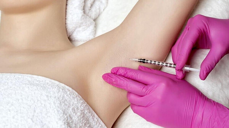 armpit botox