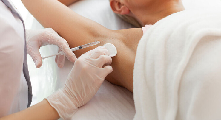 armpit botox